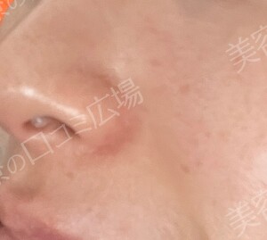 治療前の症例写真