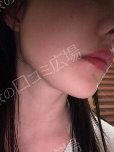 治療前の症例写真