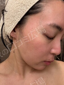 治療前の症例写真