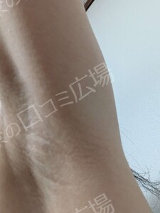 治療前の症例写真
