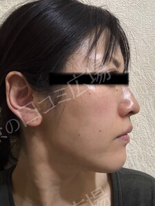 治療結果の症例写真