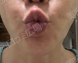治療結果の症例写真