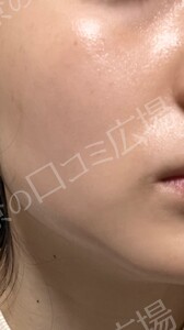 治療結果の症例写真