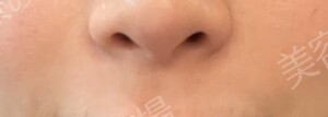 治療結果の症例写真