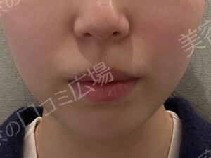 治療前の症例写真