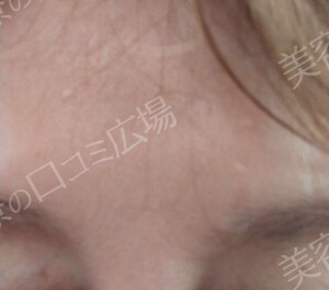 治療前の症例写真