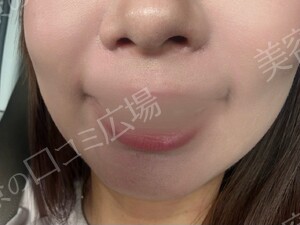 治療前の症例写真