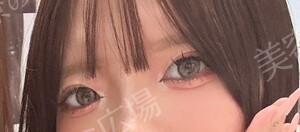 治療前の症例写真