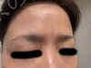 施術前の状態