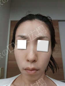 治療結果の症例写真