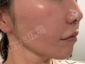 治療結果の症例写真
