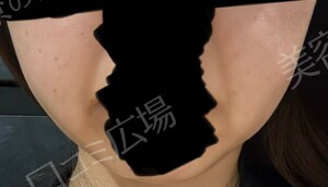 治療前の症例写真