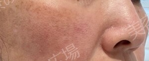 治療結果の症例写真