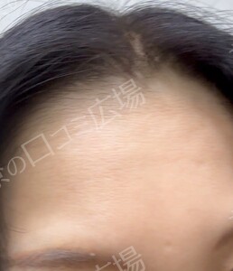 治療前の症例写真