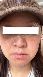 治療前の症例写真