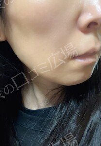 治療結果の症例写真