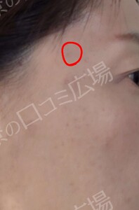 治療結果の症例写真