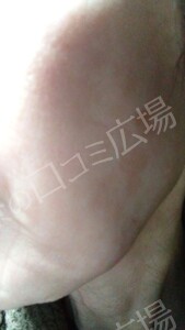 治療結果の症例写真
