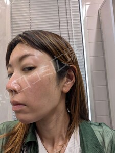 治療前の症例写真