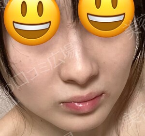 治療前の症例写真