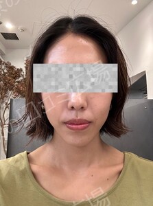 治療前の症例写真