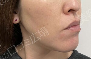 治療前の症例写真