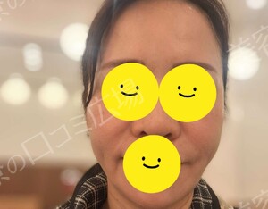 治療前の症例写真