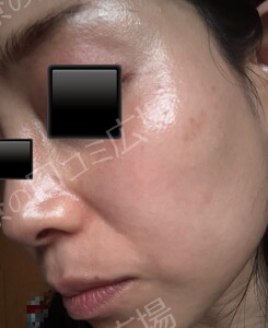 治療結果の症例写真