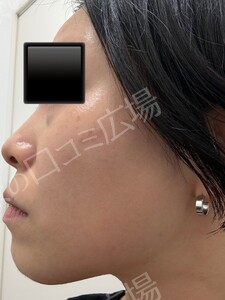 治療前の症例写真