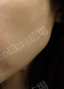 治療結果の症例写真