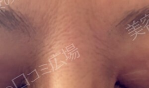治療前の症例写真