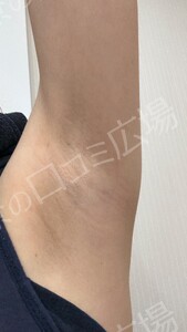 治療前の症例写真