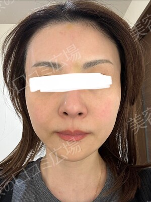 ギャラリークリニックの症例写真[アフター]