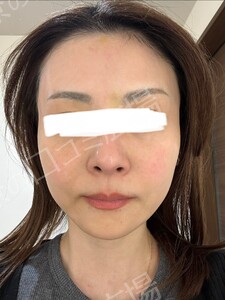 治療結果の症例写真