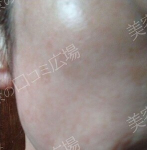 治療結果の症例写真