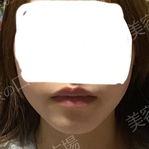 治療前の症例写真