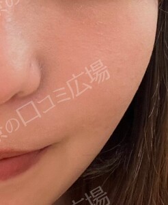 治療前の症例写真