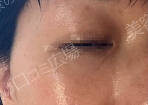 エバーグリーンメディカルクリニックの症例写真[アフター]