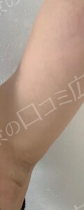 治療前の症例写真
