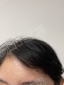 治療結果の症例写真
