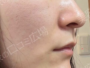 治療前の症例写真