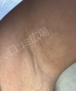 治療結果の症例写真
