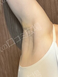 治療結果の症例写真
