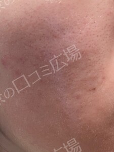 治療前の症例写真