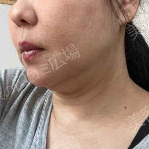 治療結果の症例写真