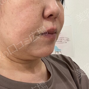 治療結果の症例写真