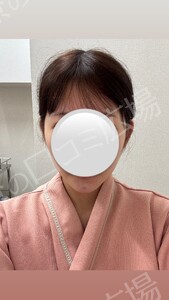 治療前の症例写真