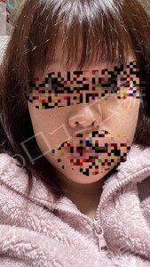 治療結果の症例写真