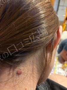 治療前の症例写真