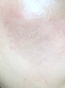 治療結果の症例写真